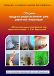Книга Сборник народных рецептов лечения рака различной локализации автора Сергей Степочкин