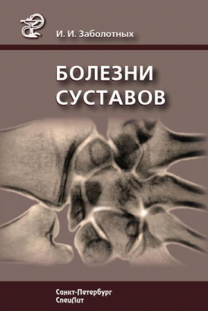 обложка книги Болезни суставов - Инга Заболотных