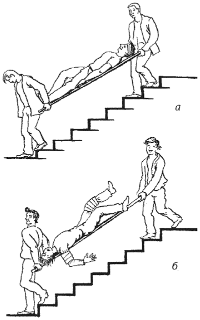 Слабость при подъеме по лестнице. Транспортировка пациента на носилках вниз по лестнице. Передвижение на носилке по лестнице. Транспортировка пациента по лестнице. Транспортировка больного по лестнице.