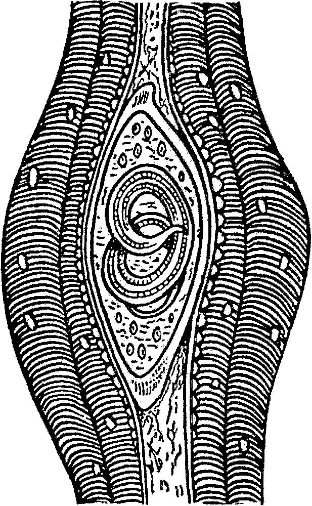Строение трихинеллы рисунок