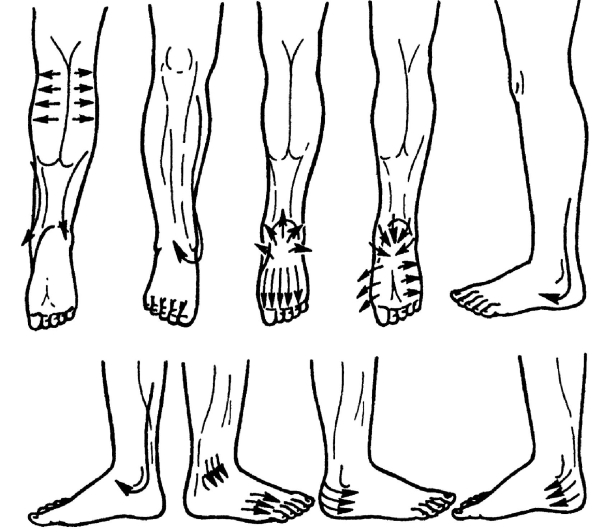Массаж при полинейропатии. Направление массажных движений при массаже нижних конечностей. Массаж ног схема. Массаж стопы схема. Массаж нижних конечностей схема.