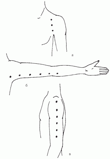 После перевозбуждения болят. Шиацу точечный массаж точки. Японский точечный массаж шиацу. Акупунктура при ДЦП точки. Болевые точки для массажа.