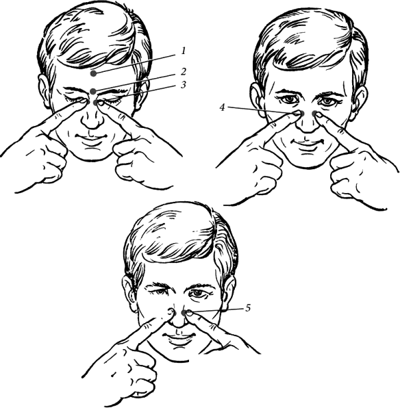 Точки от насморка. Точечный самомассаж переносица точка 1. Точки для массирования при заложенности носа. Точечный массаж от насморка и заложенности носа. Акупунктурные точки при насморке.