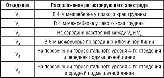 Схема электродов при экг