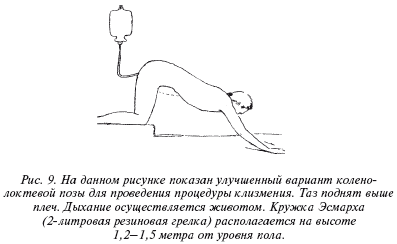 Позы для зачатия ребенка картинки с описанием