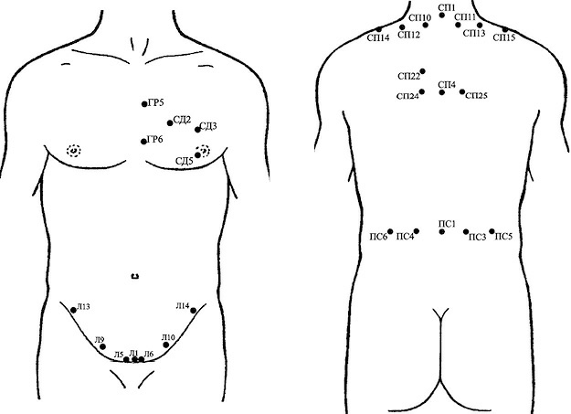 Точки для гирудотерапии картинки