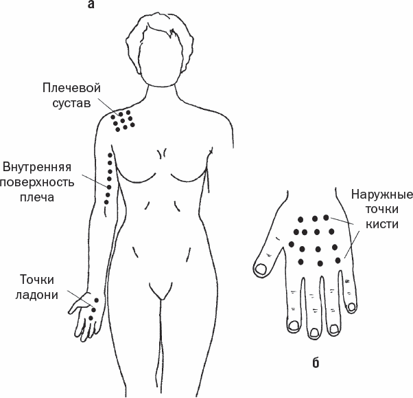 На какие точки ставят пиявки схема