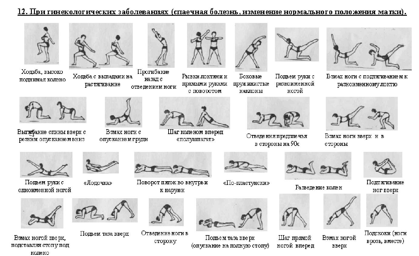 Зарядка амосова 1000 движений в картинках