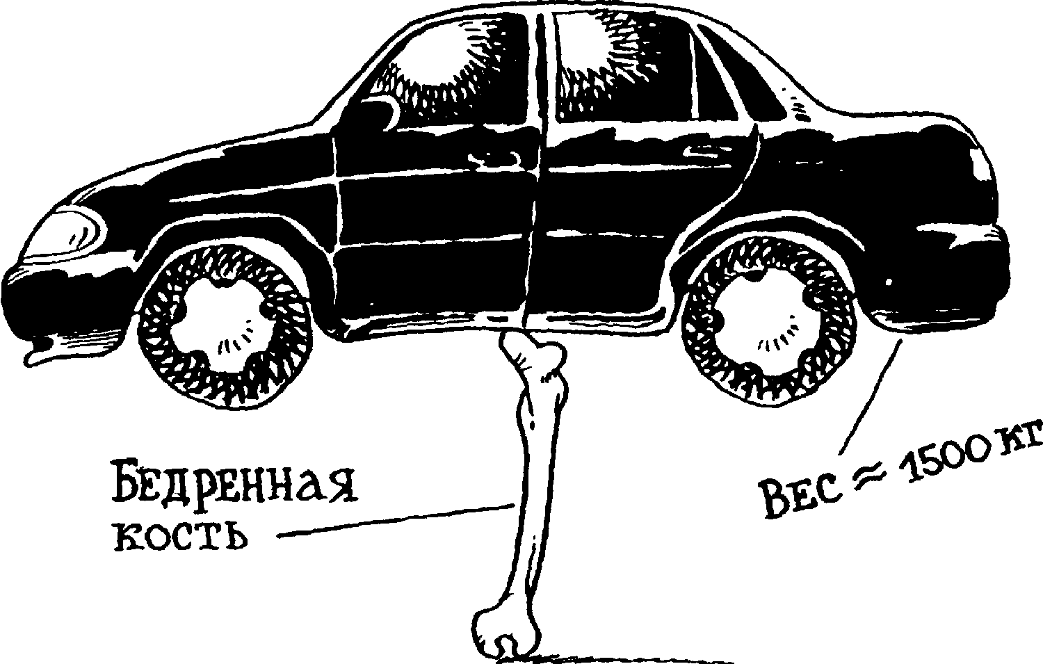 Самая крепкая кость в теле человека. Прочность костей. Кость и автомобиль. Бедренная кость выдерживает нагрузку. Прочность костей человека.