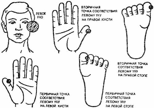 Левое правое ухо. Су-Джок точки уха. Точки Су Джок при отите. Су Джок терапия уши. Ухо Су Джок соответствие.