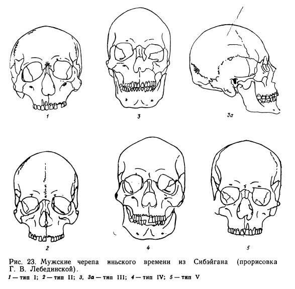Формы черепа у мужчин. Форма черепа. Формы черепа человека. Типы черепа человека.